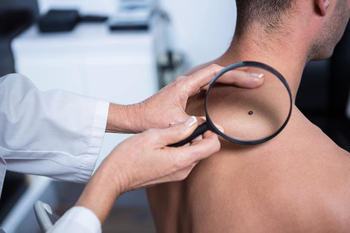 Doctor Inspecting a Patient's Skin